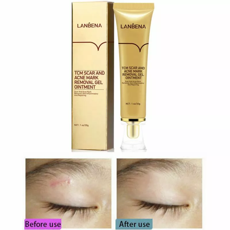 ژل ترمیم کننده جای زخم و آکنه LANBENA